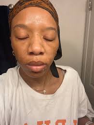 Texas woman says lemur attacked her at Austin aquarium