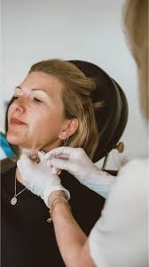 Susie Wall's EMFACE® Experience. @susiewallstyle — TV style icon, mom,  stylist, collab designer, and longtime patient—became interested in trying  EMFACE® after seeing a friend's amazing before & after photos. Coupled with  her