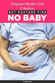 Pregnant Mother Gets C Section But Doctors Find No Baby Pregnant Mother Pregnant Parents Baby
