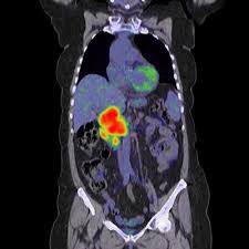 This will allow for any final proprietary and confidential. Osirix Dicom Viewer Dicom Image Library