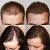 How To Get Thick Hair Home Remedies