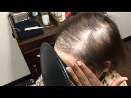 Beauty services, hair salons, hair stylists. Extreme Hair Makeover 4 Thinning Hair Los Angeles Hair Salon Stylist Lee Youtube
