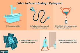 Image result for Voiding Cystourethrogram