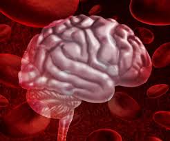 L'emorragia cerebrale è una sindrome neurologica acuta dovuta alla rottura di un vaso arterioso cerebrale e al conseguente stravaso di sangue nel parenchima cerebrale. Emorragia Nel Cervello Sintomi Trattamento Conseguenze Prognosi