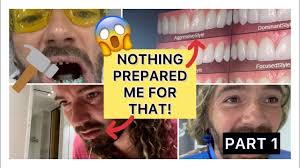 Incredibly HONEST, MOVING account of my TEETH transformation… and WHY I did  it!😔 Full reveal at end!