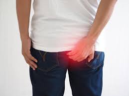 These providers can provide more advanced hemorrhoid treatment, such as: Top Signs Of A Thrombosed Hemorrhoid Betsy F Clemens M D Board Certified Physician