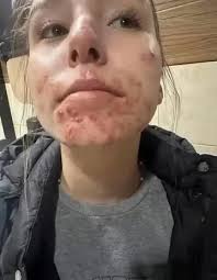 These are the consequences of sleeping with...see more in comment 👇