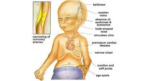 That cellular instability leads to the process of premature aging and disease in progeria. Progeria