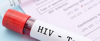 Get Tested For Hiv In Minutes