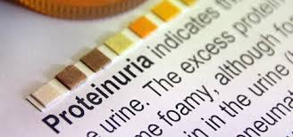 Image result for Isolated Proteinuria