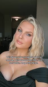 Sfillers Ruined My Face