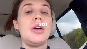 Pregnant Megan McKenna reveals she was rushed to hospital after having a  'painful' allergic reaction which caused her tongue and neck to 'double in  size' as she gives a health update |