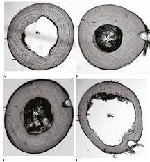 Find the perfect bone cross section stock photos and editorial news pictures from getty images. Femur Bone Cross Sections Of Four Year Old Parthenogenetic Lizards Of Download Scientific Diagram