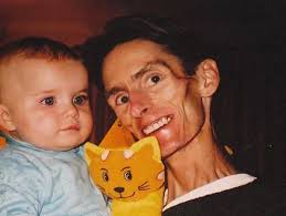 Anorexic men.. starving to death in silence