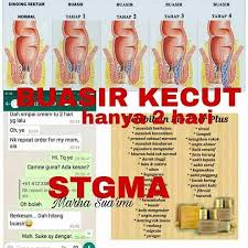 Ada empat peringkat buasir yang perlu diberi perhatian: Krim Cantik Bio Ever Plus Age Reversing Cream Posts Facebook