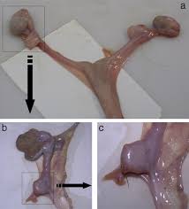 Image result for True Hermaphroditism