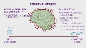Image result for Acute Vision Loss