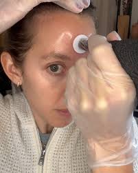 I know you’ve been seeing me post nonstop about how much I love  micro-channeling but I’ve recently taken it up a notch and began combining  micro-channeling with light chemical peels to treat all kinds ...