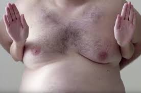This section describes options for diagnosing breast cancer in men. This Breast Cancer Charity Is Using Man Boobs To Avoid The Social Media Ban On Female Nipples