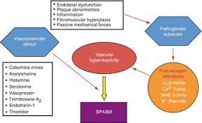 Image result for Angina Pectoris