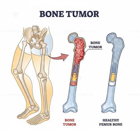 Long bone anatomy