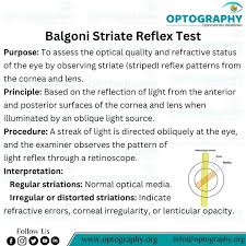 Image result for Optical Reflex