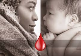 COVID-19 Convalescent Plasma (CCP) COVID-19 Convalescent Plasma (CCP)