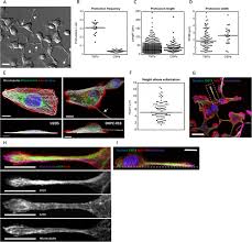 Maybe you would like to learn more about one of these? Tumor Microtubes Connect Pancreatic Cancer Cells In An Arp2 3 Complex Dependent Manner Molecular Biology Of The Cell