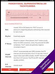 Download Ecg Flashcards 2 Lite Free Reference Ekg App Free For Android Ecg Flashcards 2 Lite Free Reference Ekg App Apk Download Steprimo Com