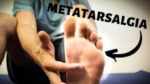 Check these 10 best metatarsal pads for running and get 100% relief right now! 10 Best Metatarsal Pads To Cure Your Foot Pain In 2021 Test10best