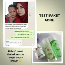 Namun moms perlu melihat beragam manfaat yang ditawarkan oleh pare jika rajin mengonsumsinya. Terlaris Paket Theraskin Acne Bpom Obat Jerawat Wanita Pria Remaja Ibu Hamil Dan Menyusui Shopee Indonesia