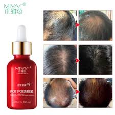 Hair loss from medication usually ceases once people stop taking the medication. Hair Loss Treatment For Women Lifestyle Changes That May Slow Down Hair Loss