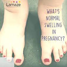 Swelling In The Third Trimester What S Normal When To Worry What To Do