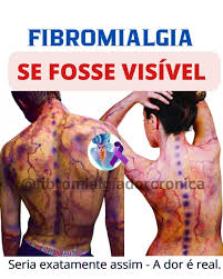 Fibromialgia - A fibromialgia é uma doença reumática crônica que afeta músculos, ligamentos, tendões, articulações e envolve uma grande quantidade de sintomas que afetam qualquer parte do corpo. Temos toneladas de músculos,