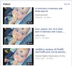Fact Check Baby Born With 3 Eyes In Germany