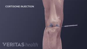 Image result for Cortisone