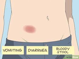 It is important to know the signs and get treated right away. 5 Ways To Dissolve Blood Clots Wikihow