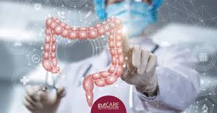 A higher number, such as stage iv, means cancer has spread more. What Does Each Stage Of Colorectal Cancer Really Mean