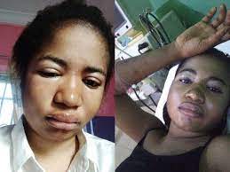 Ada jesus was diagnosed with a kidney problem that left her incapacitated for months now. Comedienne Ada Jesus Dead After Battle With Kidney Diseaseguardian Life The Guardian Nigeria News Nigeria And World News