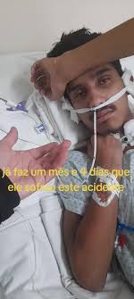 este é o Willian sofreu um acidente de moto onde veio bater muito forte sua  cabeça e teve uma lesão chamada,lesão axonal difusa,ficou 15 dias em coma  por causa da batida,tbm quebrou a coluna tem o ...