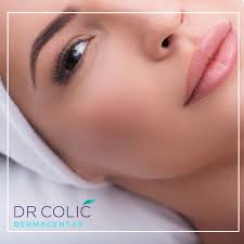 LIFTING OBRVA Idealno oblikovane i pozicionirane obrve su veoma bitan deo  lica koje izgleda sveže, mladalački i atraktivno. Pozicija obrva se menja  aktivacijom grupa mišića na tom delu lica. Botoks i drugi