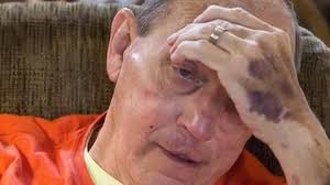 Alzheimer's disease: A wife cares for a husband who forgot how to care