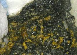 Doc, saya mempunyai bayi berusia 3 bulan, berat 7kg (berat, tetapi dia tidak gemuk kerana ketinggian panjangnya), dan diberikan susu formula. Baby Poop A Visual Guide Babycenter