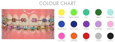 Braces Colour Chart Oremdentist Braces Colors Braces
