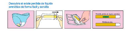 Anomalías neurológicas como anencefalia o problemas que lleven a una obstrucción del esófago fetal. Comprar Al Sense Kit Detector De Perdidas De Liquido Amniotico A Precio Online