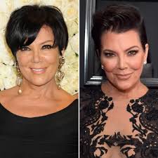 From Felicity Huffman To Kathy Griffin These Stars Aren T Shy About Talking About Their Facelifts Plast Plastic Surgery Celebrity Plastic Surgery Facelift