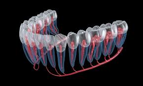 How is the root canal procedure done? Root Canal Failure Symptoms Reasons And Treatment Voss Dental Oral Surgery Implant