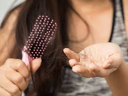 It is unusual for mild (e.g. How Thyroid Disease Can Cause Hair Loss Hair Transplant Toronto