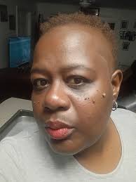 2 year Survivor! 🩷💕🩷💕