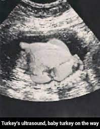 Turkey S Ultrasound Baby Turkey On The Way Turkey S Ultrasound Baby Turkey On The Way Ifunny